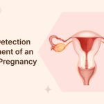 Timely-Detection-&-Treatment-of-an-Ectopic-Pregnancy